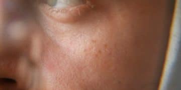 Dark Circles Under Eyes: 4 Proven Treatments for Men That Actually Work - Cover Image