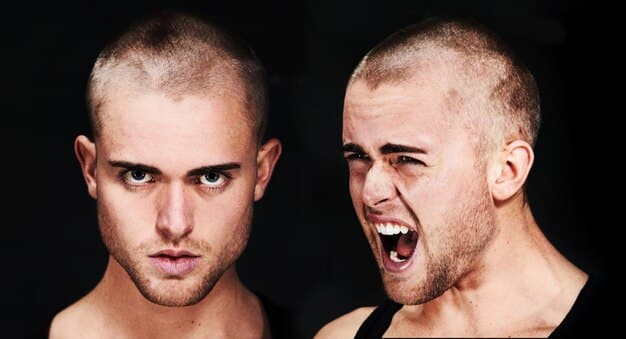 Unbiased Review: The 3 Best Hair Loss Shampoos for Men in 2025
