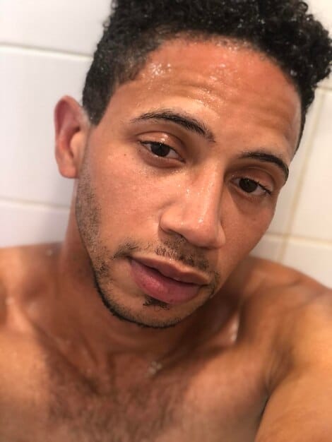 Ingrown Hairs Be Gone: Expert Shaving Tips for Men – The Ultimate Guide