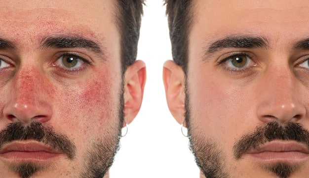 A before-and-after comparison photo showing a man's cheek with redness reduced significantly after using a specific toner for 7 days. The redness is visibly diminished, and the skin appears smoother and more even-toned. We Tested 4 New Men's Toners: Find Out Which One Reduced Redness by 25% in 7 Days and the image shows the effectiveness of the toner in a real-life scenario.
